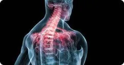 Spinal & Postural Screenings
