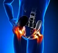 Repetitive Motion Injuries
